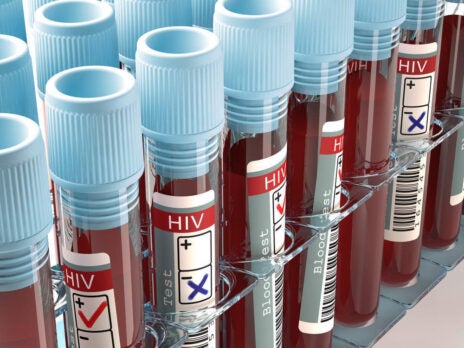 The US is lagging when it comes to HIV treatment