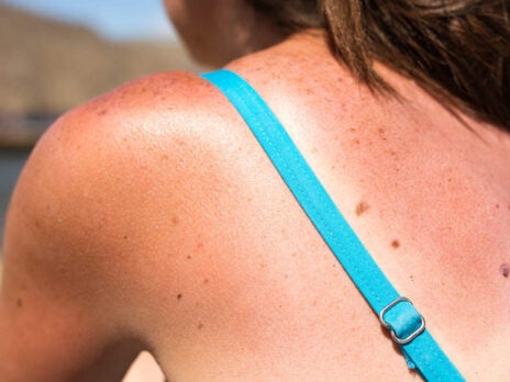 Everyone's way more concerned about sun damage than they used to be