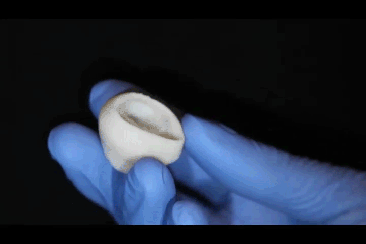 3D printed heart valve