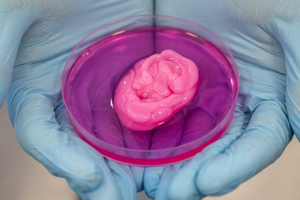 3D printing: What is the executive and medical view on the tech in healthcare?