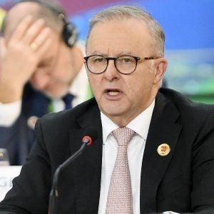 Anthony Albanese